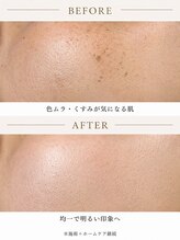 ハス(hasu.)/月1回施術＋ホームケア継続
