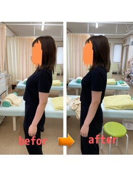 あべ整骨院 整体院/反り腰