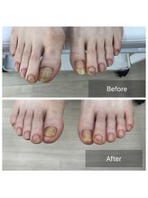 ドクターネイル爪革命 北千住店/トータルフットケア