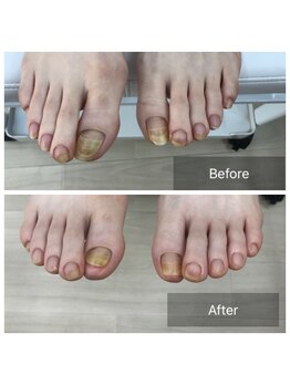 ドクターネイル爪革命 北千住店/トータルフットケア