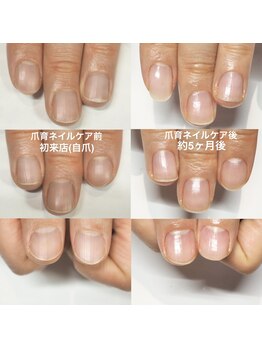 ニコプラス(NICO+)/爪育ネイルケア