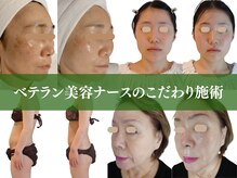 モチポカ 本駒込(mochipoca)