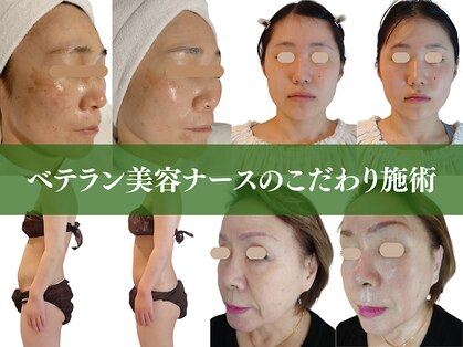 モチポカ 本駒込(mochipoca)の写真