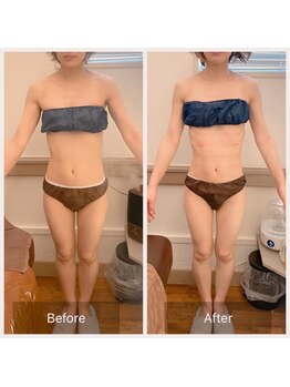 カルナ(carna)/《2か月計4回》2週間に1回