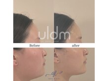 グレイスリリー 久屋 栄(grace lily)/NEW施術*uldm