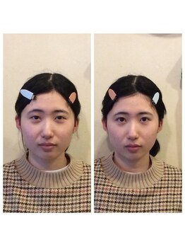 健幸堂 本店/小顔矯正1回