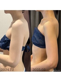 サロン ド ブラン アオヤマ(Salon de BLANC AOYAMA)/