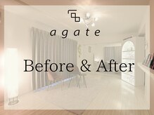 アガットバイミヤモト(agate by miyamoto)/施術ビフォーアフター集