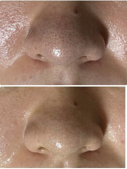 マリエンドリー/