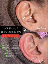 ジョエルワックス 沖縄那覇店(JOELLE WAX)/耳まわり産毛気になりませんか？