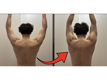 スキャプレーン 米子(SCAPLANE)/BEFORE AFTER事例