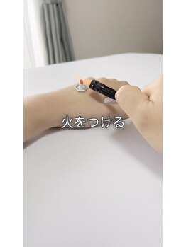 経絡鍼灸院 野村/お灸のやり方#3