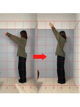 整体院アワヤ(AWAYA)/お客様のビフォーアフター