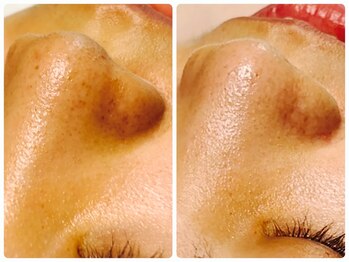 ベルドア(Bell Door)/毛穴ケア/黒ずみケア