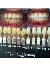 トウキョウスワーズ 池袋店(TOKYO SWRS)/#ホワイトニング #池袋 #渋谷