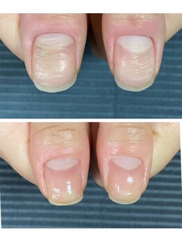 ルカロンネイル(Rukaron Nail)/凸凹爪