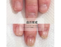 シュシュ(shou shou)