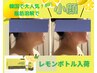 【脂肪分解小顔】レモンボトル回数券×5回分64000→50000