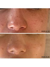 オーク(o.a.k)/お客様ビフォーアフター