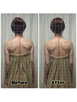 エビアス(Ebias)/シエル深頭αセラピー効果4