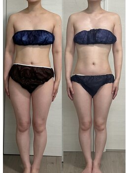 ヨルエステ(yoru aesthe)/【姿勢矯正、痩身、歪みとり】