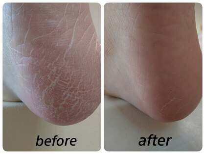 あし処 トコトコ(tocotoco)の写真