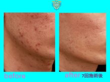 リュクス(LUXE)/ビフォーアフター