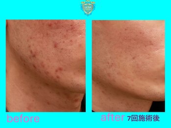 リュクス(LUXE)/ビフォーアフター