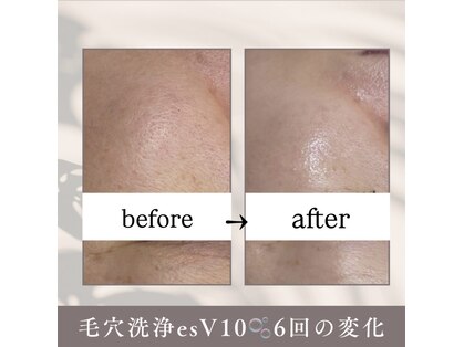 ルネ(Renee)の写真