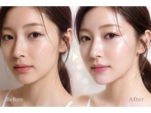 エムアイ 六本木(Mi)