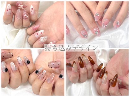 リノネイル(Rino-nail)の写真