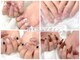 リノネイル(Rino-nail)の写真