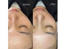 ハイク バイ ジェン(HIKE by gen.)/フェイシャルワックス