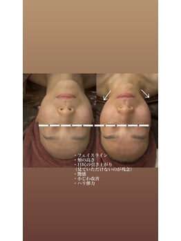 ヴィクトワール シュエット/50代のお客様の変化