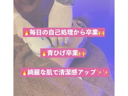 カーム(CALM)の写真