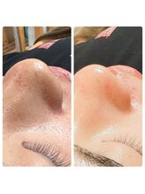 リバイバル(Re:vival)/男性も美容メニュー♪