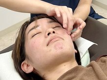 太陽鍼灸接骨院/美容鍼