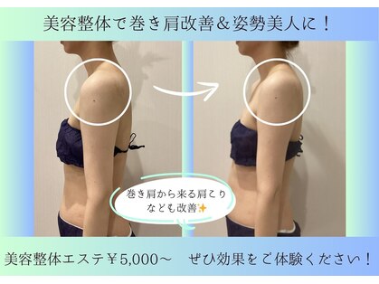 リシェルの写真