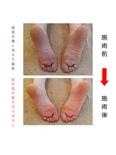 ナチュラルハリー(NaturalHarry)/【足ツボbefore→after】