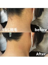 ブルームーン(BLUE MOON)/うなじ脱毛デザインシェービング