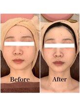 スペチアーレ 夙川/劇的変化で小顔に