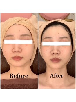 スペチアーレ 夙川/劇的変化で小顔に