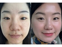 ベリッシマ(Bellissima)の雰囲気（根本の肌質改善で繰り返さないお肌に。終わりのあるサロンです☆）