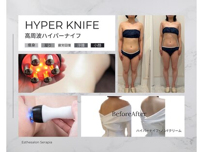 ゼクサースポーツスタジオ(ZEXER SPORTS STUDIO)の写真