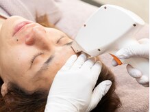 【眉がキマる】眉回り＆鼻毛はLED脱毛でムダ毛処理完了！