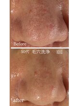 マリエンドリー/