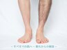 【お試しOK】men's M/Lパーツ脱毛(選択可)5,800→3,980