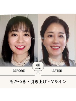 ふらっとエステ/必要なのは今すぐ綺麗になる決心