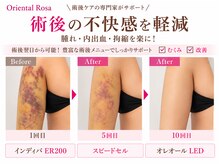 オリエンタルローザ 表参道(Oriental Rosa)の雰囲気(術前ケアや術後翌日からケアができる!安心の専門スタッフ対応!)