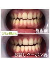 ルブラン 奈良店(Le Blanc)/接客業のお客様！